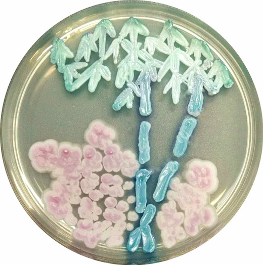 微生物显色平板培养艺术大赛